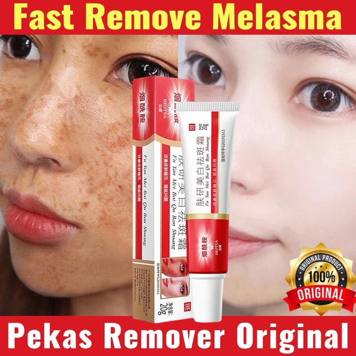 Gambar ranhe - [New] Salep Flek Hitam Melasma Flek Hitam Niacinamide Melasm Cream  Ampuh Whitening Salep Flek Hitam Whitening Salep Flek Hitam Krim Penghilang Flek Menghilangkan Bintik Melasma Untuk Moisturizer Brightening Krim Pencerah Wajah Yang Aman 20g dari ranhe undefined Tokopedia