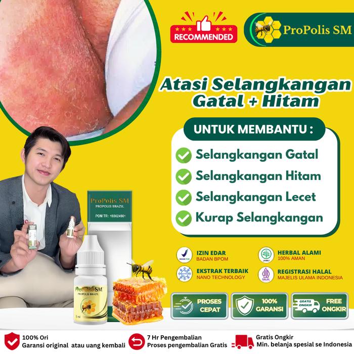 Gambar Propolis Sm - 0bat Gatal Selangkangan Hitam Burik, Selangkangan Jamuran Berjamur, Kurap Selangkangan Lecet, Kurap di Selangkangan dari Zubair Healty undefined Tokopedia