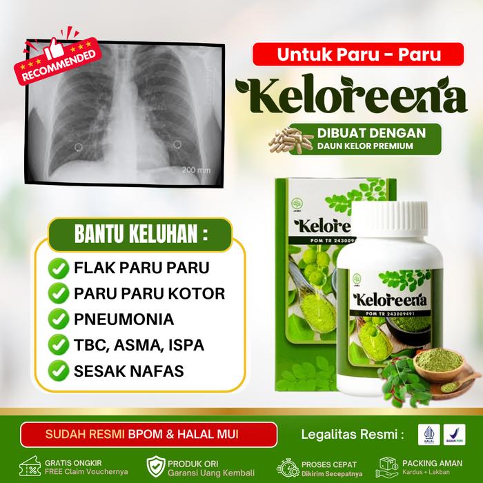 Gambar Keloreena - Flek Paru, Bercak Di Paru Penyakit Tuberkulosis / TBC Sesak Nafas, Asma, Bronkitis, Obat Pembersih Paru Paru Kotor, Flek di Paru Kotor, Paru Paru Basah, Pneumonia, Bronkitis Asli 100% Alami - 50 KAPSUL dari Herbal 3A undefined Tokopedia