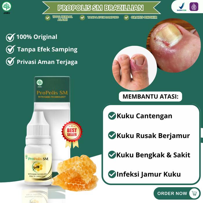 Gambar Propolis SM Tetes Kuku Cantengan Bernanah Bau Kuku Rusak Berjamur Kuku Jempol Kaki Bengkak dari DanielHerbalShop undefined Tokopedia