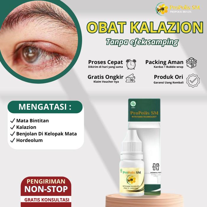 Gambar Mata Bintitan Timbilan Pengempis Benjolan Di Kelopak Mata Penghilang Bintitan Propolis Sm dari Herbalthy Store undefined Tokopedia