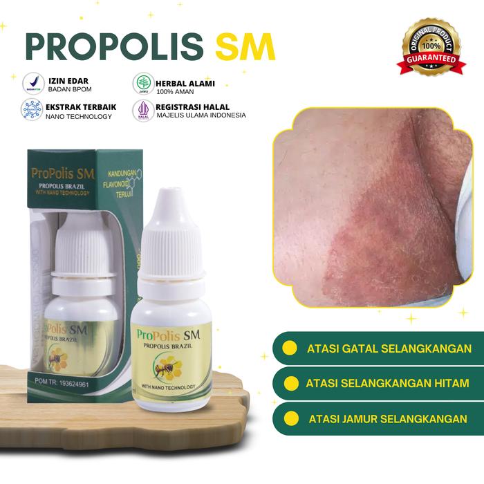 Gambar Propolis Sm Atasi Gatal Selangkangan Hitam Burik, Selangkangan Jamuran, Pemutih Selangkangan dari Nafiza herbal undefined Tokopedia