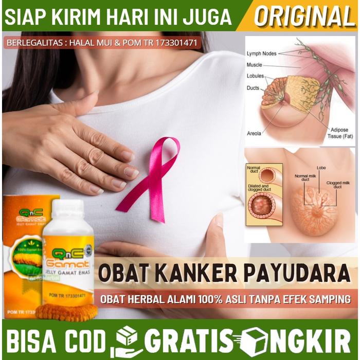 Gambar NEW Obat Tradisional Untuk Penyakit Tumor Payudara, Pengobatan Alami dari Romantika storee undefined Tokopedia