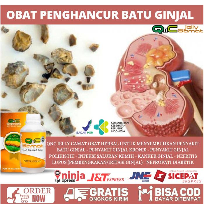 Gambar NEW Obat Tradisional Alami Untuk Penyakit Ginjal Akut - Penghancur dari Romantika storee undefined Tokopedia