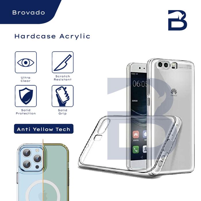Gambar Casing Huawei P10/P10+ Plus Hardcase Acrylic Mika Bening Transparan - P10 Plus dari BROVADO undefined Tokopedia