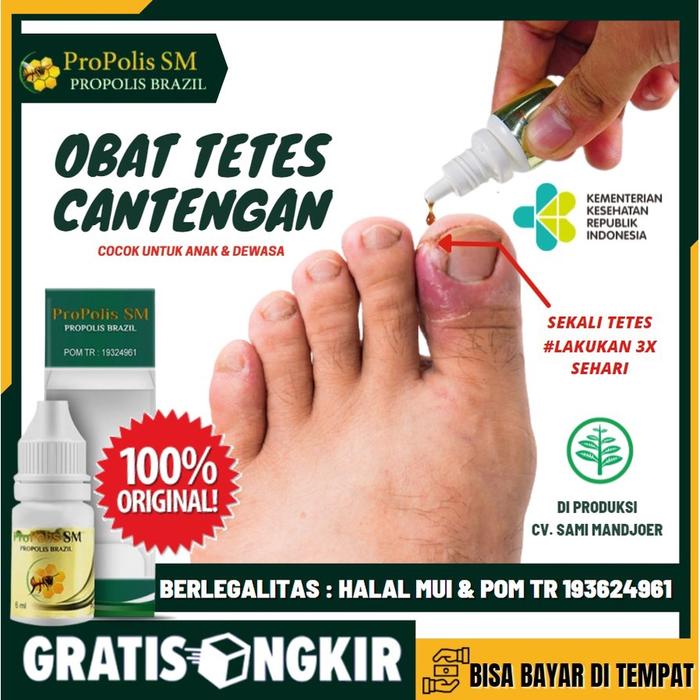 Gambar Obat Tetes Cantengan Tradisional Alami Cantengan Jempol Kaki Diskon dari nadya mustika_ undefined Tokopedia