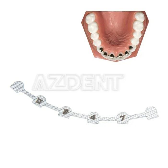 Gambar Lingual Retainer Orthodontic Individual Splint Fixed Fix Retainer - Lower 29mm dari Jaya mandiri12344 undefined Tokopedia