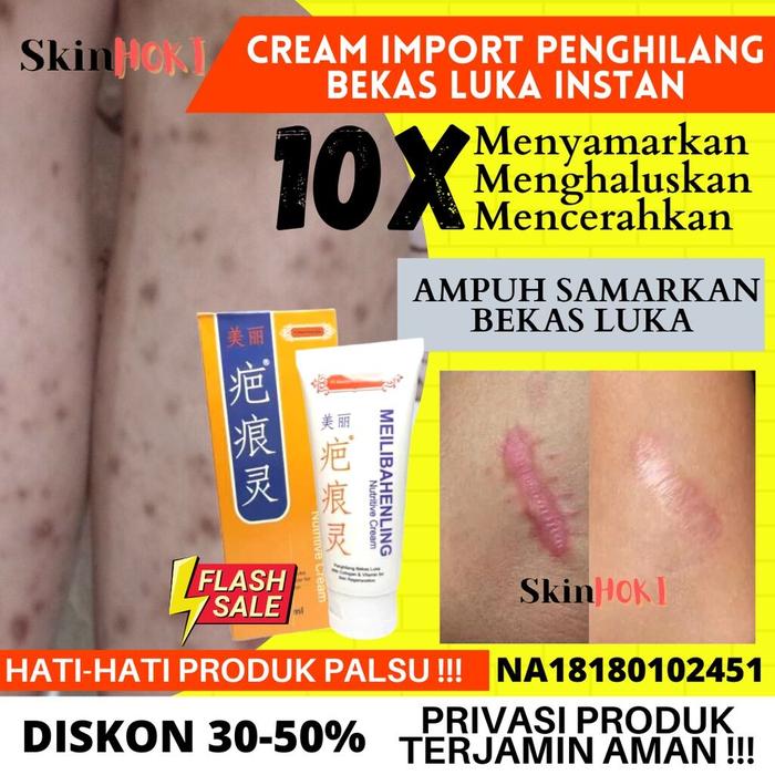 Gambar PENGHILANG BEKAS LUKA BAKAR SALEP GATAL NUTRIVE CREAM 40ml PENGHILANG KELOID MEILIBAHENLING ORIGINAL BPOM dari yonathanmart undefined Tokopedia