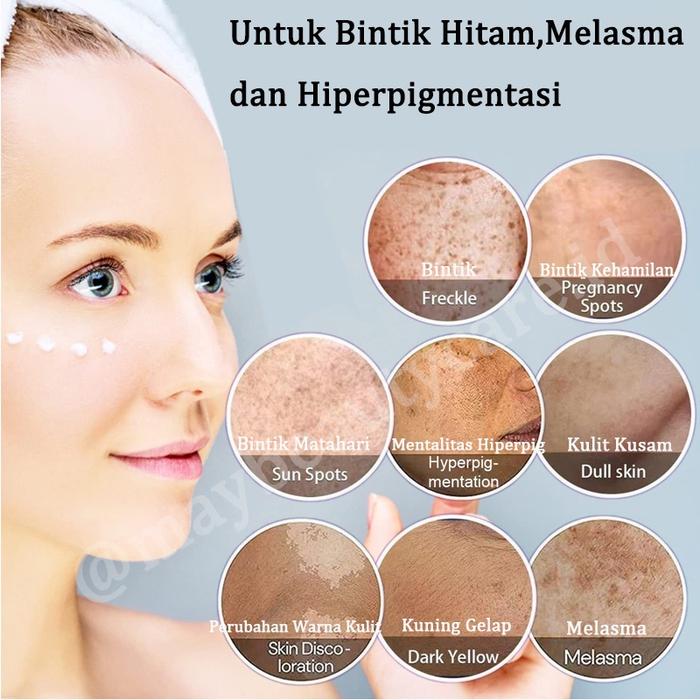 Gambar BEOTUA Whitening Freckle Cream Niacinamide Melasm Cream 20Gr Untuk Krim Pelembab Wajah Pemutih Cream Penghilang Flek Hitam Bintik Hitam Mencerahkan Kulit dari Pabyy lea undefined Tokopedia