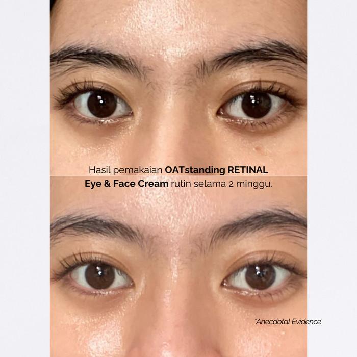 Gambar S☛A2 FINALLY FOUND YOU! OATSTANDING RETINAL - 2IN1 EYE & FACE CREAM dari faradilaemarket undefined Tokopedia