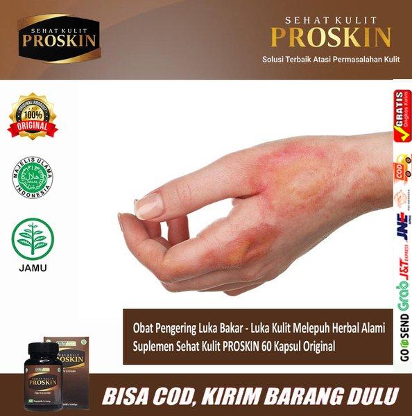 Gambar Obat Penghilang Bekas Luka Bakar - Obat Kulit Terbakar - Tersiram Minyak - Air Mendidih - Luka Melpuh Tekena Knalpot | PROSKIN Sehat Kulit Original dari Weliy628 undefined Tokopedia