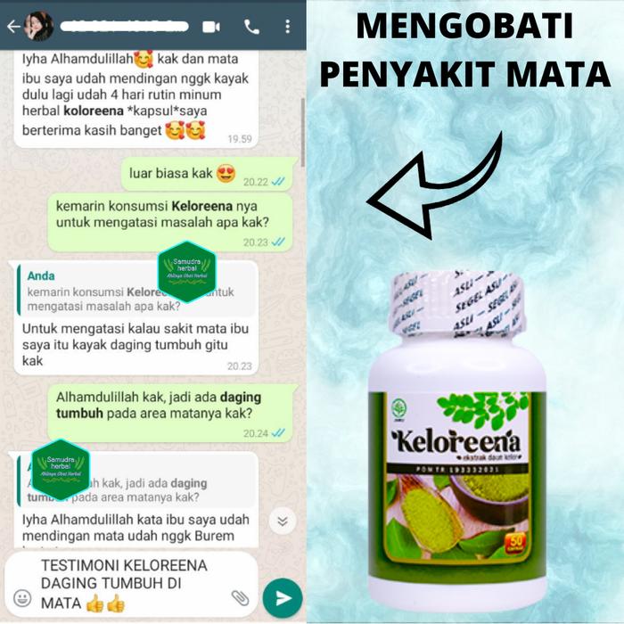 Gambar Obat Lemak Di Mata, Mata Berlemak Pterigium, Menghilangkan Selaput Lendir Pada Bola Mata - Keloreena dari storezynn undefined Tokopedia