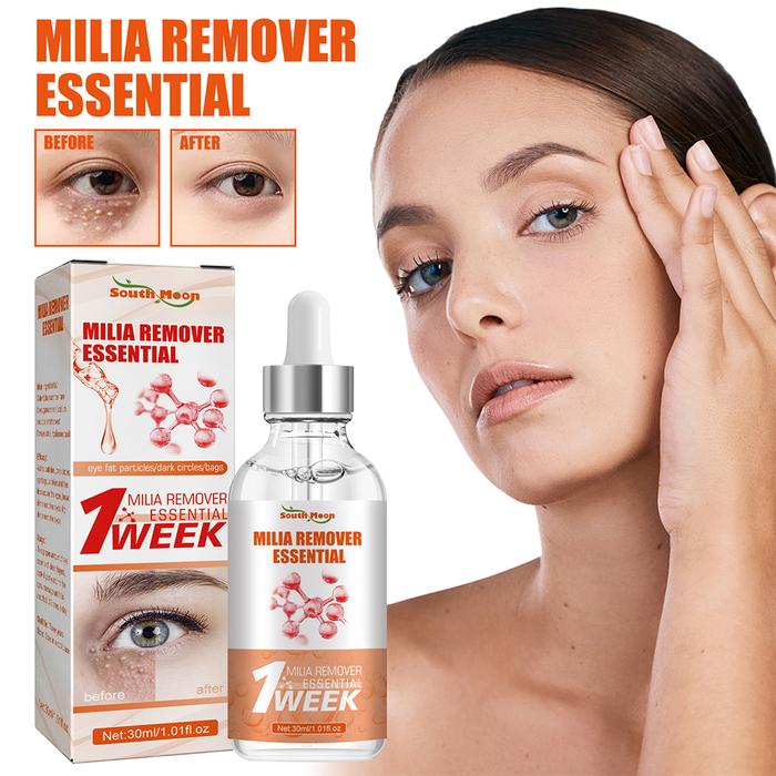 Gambar 30ml Milia Remover Essential Eye Serum Effective Removes Fat Granules Eye Bags Anti-Particles Puffiness Improve Dark Cicle dari briliz undefined Tokopedia