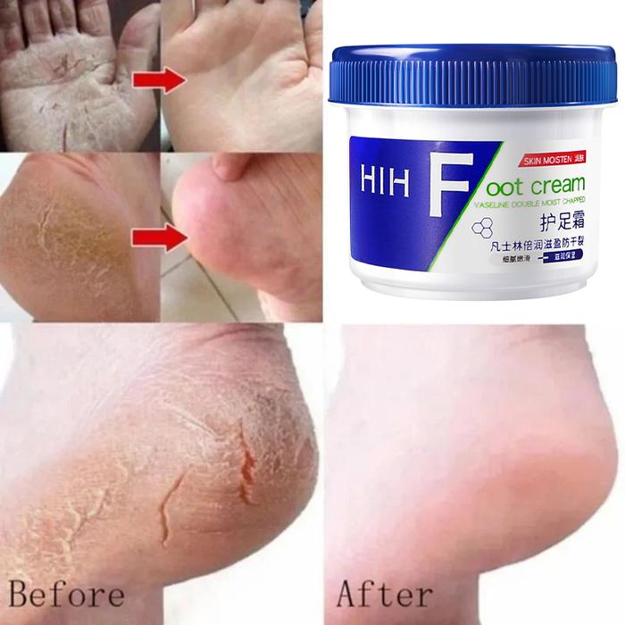 Before And After Vaseline Petroleum Jelly For Feet Vaseline Deep