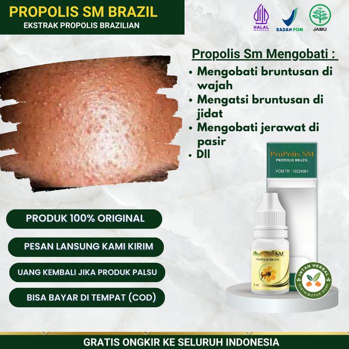 Gambar Propolis SM Mengatasi Bruntusan Di Wajah, Di Jidat, Bruntusan Di Area Mata, Jerawat Pasir dari Intan Herbal Store_NEW undefined Tokopedia