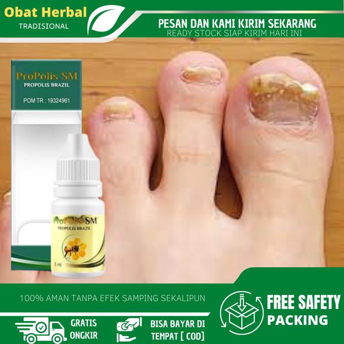 Gambar Cairan Tetes Untuk Jamur Kuku, Pemutih Kuku, Kuku Cantengan Parah, Kuku Rusak Bau Busuk, Kuku Bengkak Bernanah dari kiaherbal undefined Tokopedia