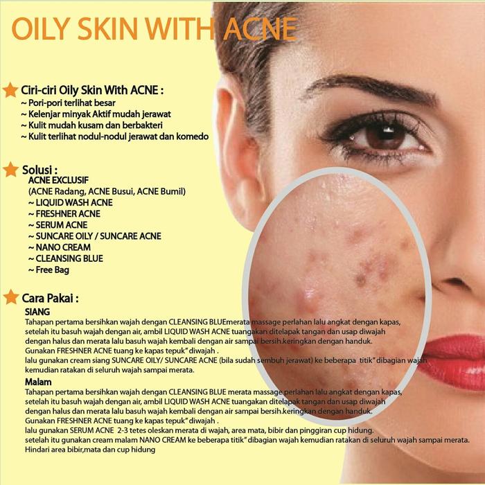 contoh acne prone skin