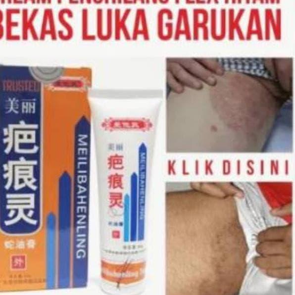 Jual Obat Penghilang Bekas Luka Bakar Cream Salep Bekas Luka Paling Ampuh Jakarta Barat Toko Kamasutra Jepara Tokopedia