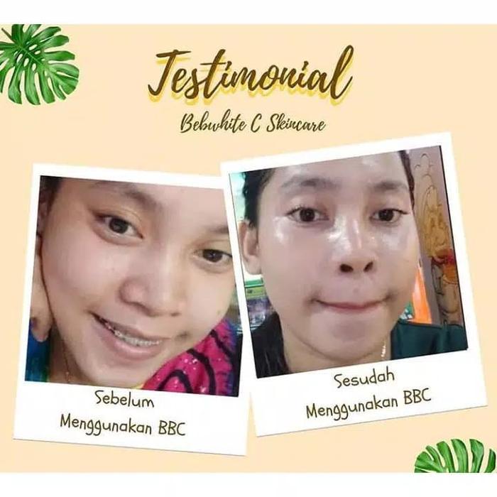 testimoni bebwhite c skincare