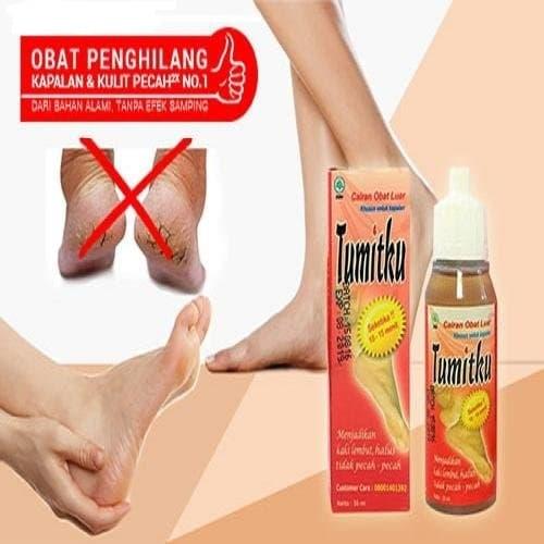 Jual Tumitku Mengatasi Kaki Pecah Pecah Kapalan Dengan Instan 100 Original 30ml Kota Bogor Herbalbeautyshopid Tokopedia