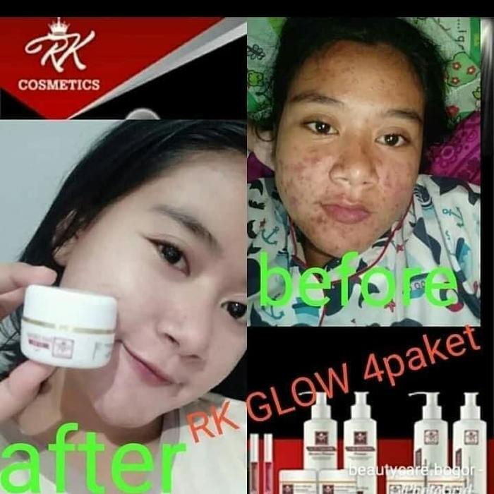 rk glow skincare