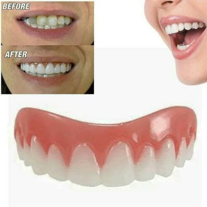 Jual Gigi Ompong Gigi Palsu Smile Veeners Pengganti Gigi Perfect Smile Jakarta Timur Tokoku Corp 
