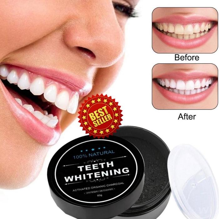 Jual Pemutih Gigi Pasta Gigi Pemutih Penghilang Karang Gigi Obat Pemutih Kab Cirebon Nurul Collection 123 Tokopedia