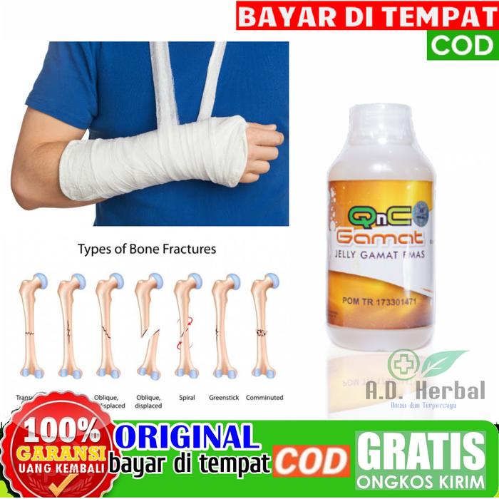 Jual Obat Patah Tulang Lengan Atas Kaki Bahu Tangan Kak Penyembuhan Cepat Jakarta Timur Ad Herbal Tokopedia