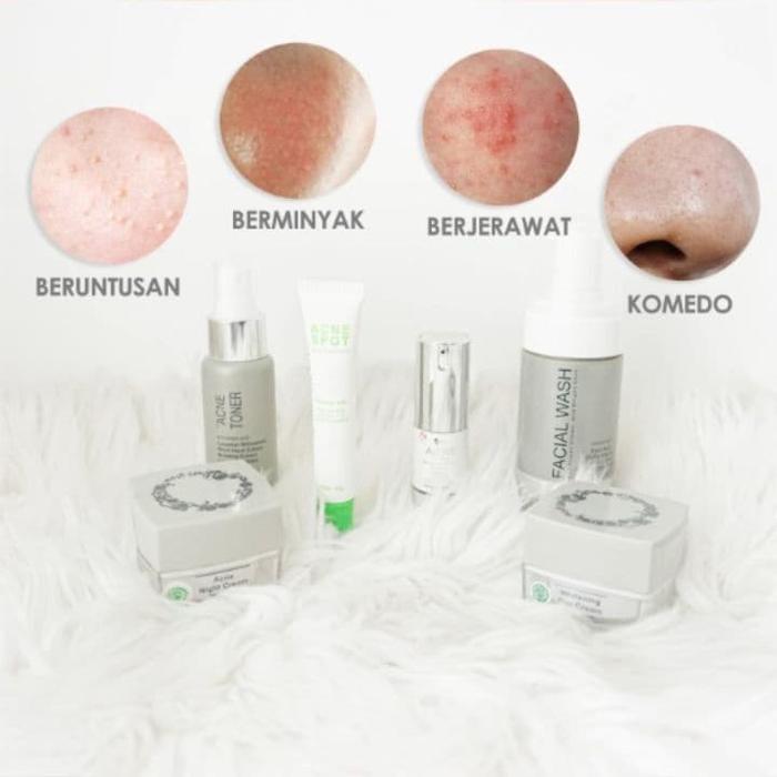 ms glow serum acne