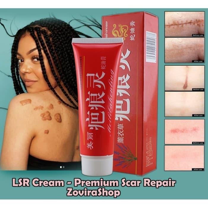 Gambar LSR Cream Ajaib Mengobati Bekas Luka Keloid, Luka Bakar, Jerawat dll - Normal Beli 1 dari Zovira Shop undefined Tokopedia