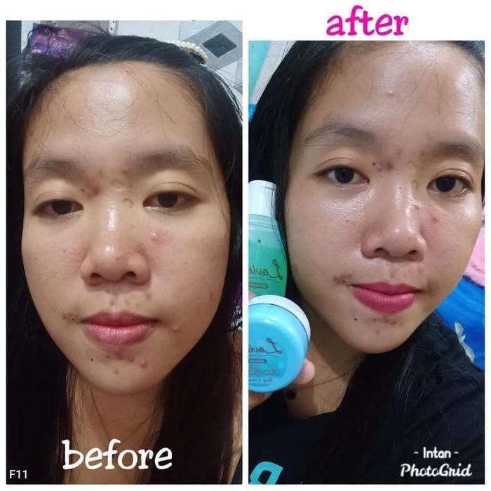 manfaat lavina skincare