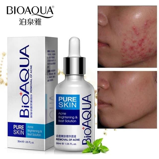 bioaqua pure skin acne