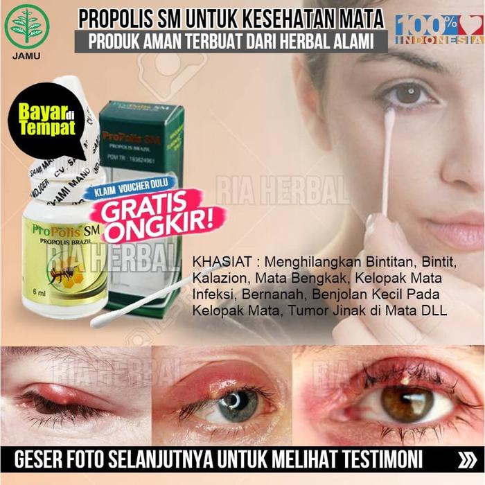 Jual Obat Bintitan Di Bawah Mata Sakit Benjolan Di Kelopak Mata Salep Oles Jakarta Barat Toko Ria Herbal Tokopedia