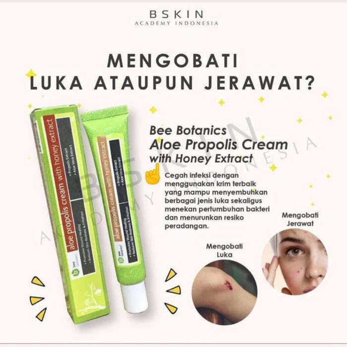 Jual Hdi Aloe Propolis Cream Bekas Luka Jerawat Jakarta Utara Lovelysmile Shop Tokopedia