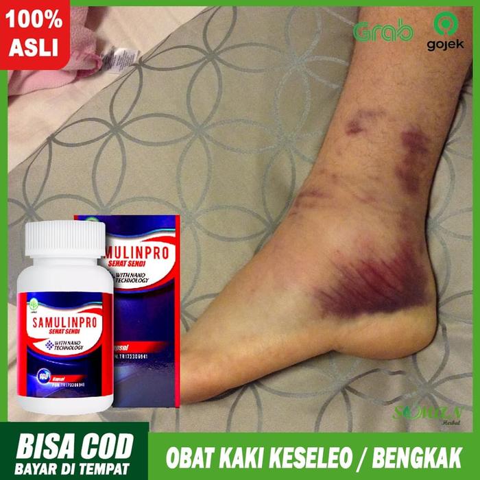 Jual Obat Kaki Keseleo Obat Cedera Otot Obat Terapi Kaki Terkilir Bengkak Kota Surabaya Walatra Sehat Sendi Tokopedia