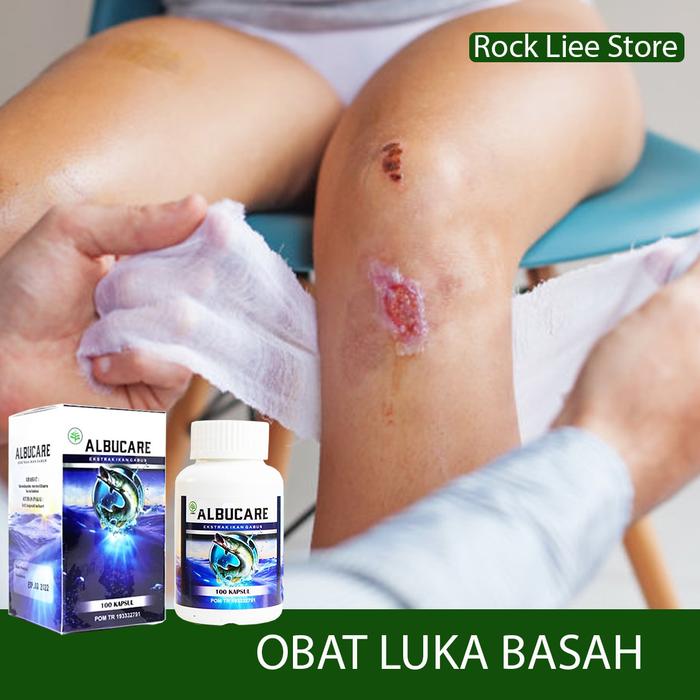 Jual Obat Luka Basah Bekas Luka Luka Basah Luka Bernanah Cenang Kota Tasikmalaya Rock Liee Store Tokopedia
