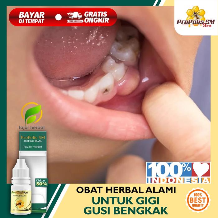 Jual Obat Sakit Gigi Gusi Bengkak Obat Sakit Gigi Obsagi Propolis Sm Jakarta Timur C V Soni Technopolis Ii Tokopedia