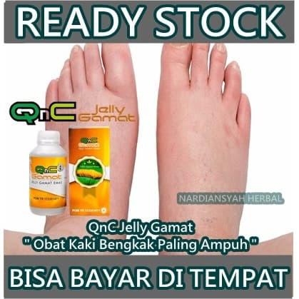 Jual Obat Kaki Bengkak Karena Asam Urat Jantung Ginjal Diabetes I Qnc Kab Bekasi Nardiansyah Herbal Tokopedia